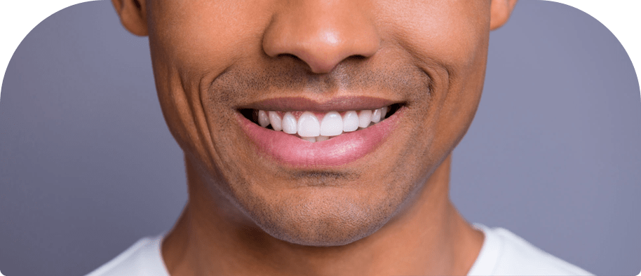 man with white teeth