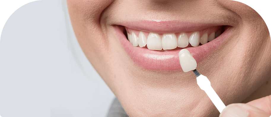 woman checking teeth color